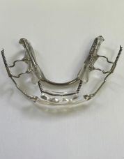 NiTi Springs Aligner s in Essex